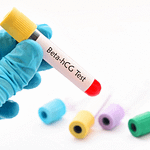 Gebelikte Haftalara Göre Beta HCG Değerleri