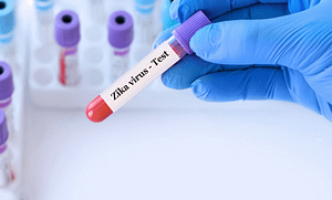 Zika Virüsü Nedir?