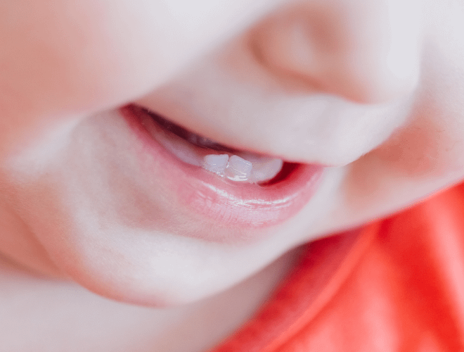 Bebeklerde Diş Çıkarma Dönemi