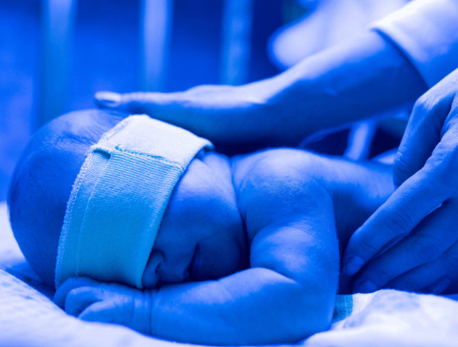 Yenidoğan Sarılığı Hakkında Bilmeniz Gerekenler