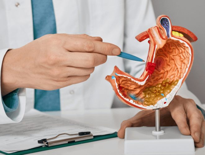 Gebelikte Mide Yanmasına Ne İyi Gelir?