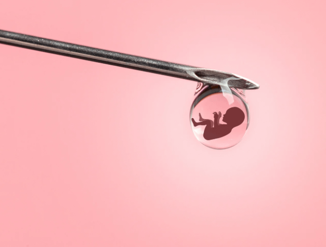 Yapay Döllenme (Tüp Bebek)