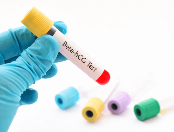 Gebelikte Haftalara Göre Beta HCG Değerleri