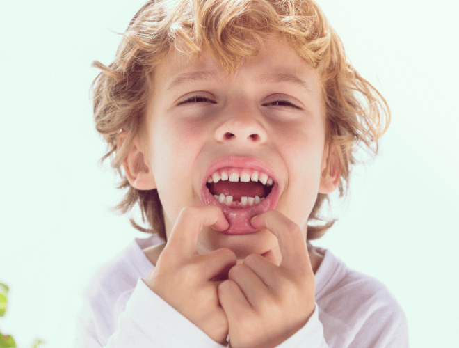 Çocuklarda Süt Dişi