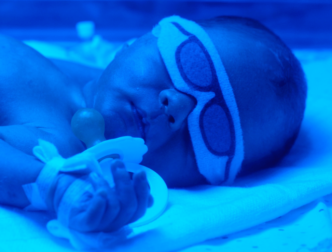 Anne Sütü Sarılığına Dair Merak Edilenler