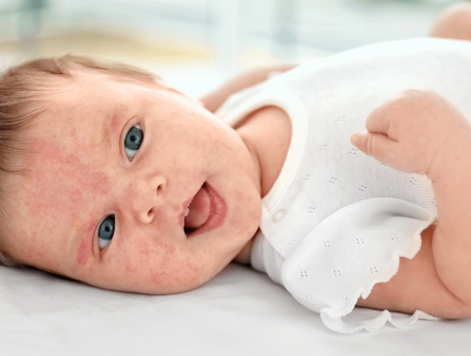 Yenidoğan İsiliği