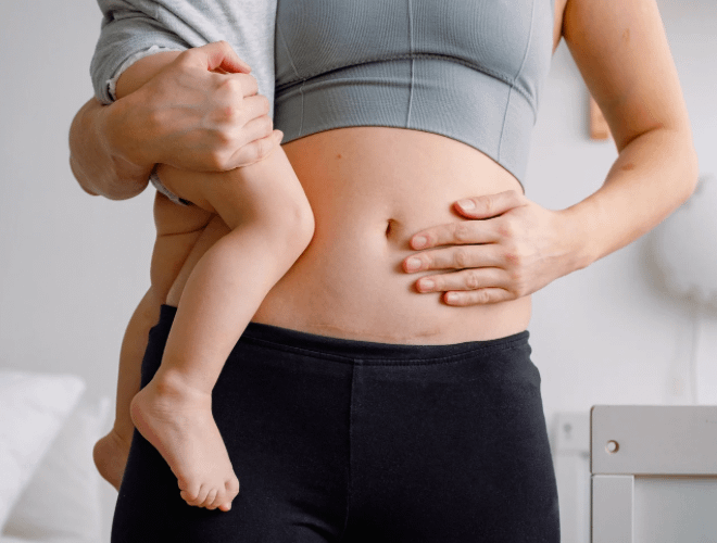 Sezaryen Sonrası Gaz Çıkarmanın Önemi