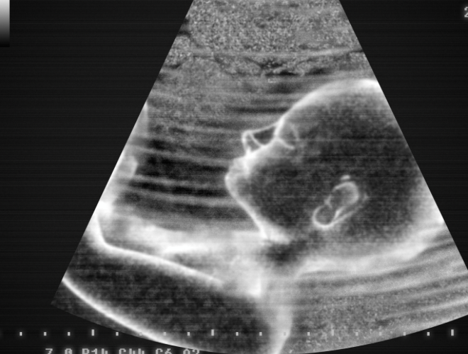 Anne Karnında Ses Var Mıdır?