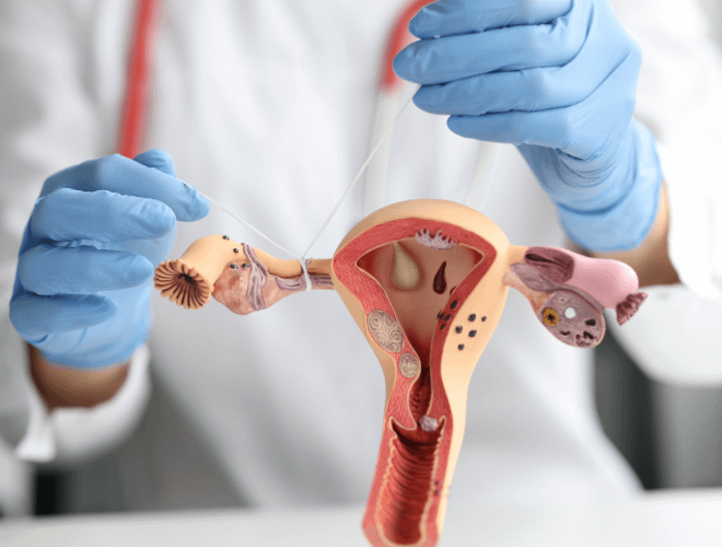 Tüp Bağlatma Nedir?