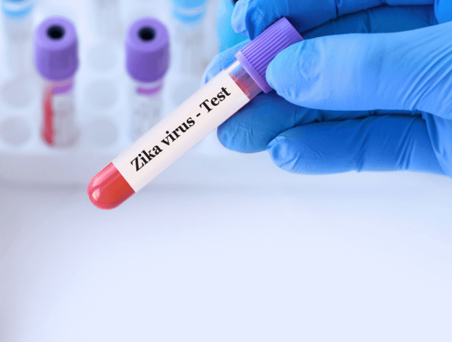 Zika Virüsü Nedir?