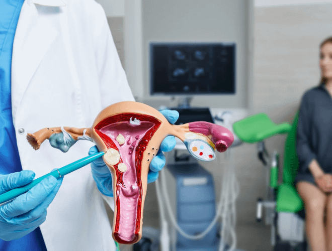 Miyomlar Gebe Kalmayı Engeller mi?