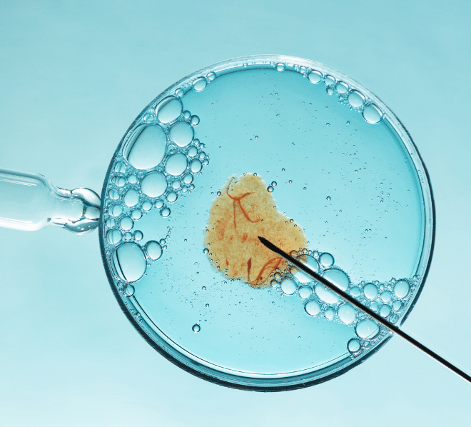 Tüp Bebek Tedavisinin Riskleri ve Önlemleri